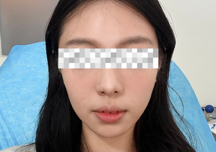 Before